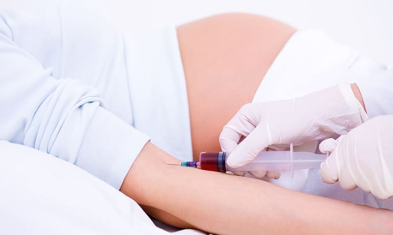 Rh Negativo aloinmunización materno fetal